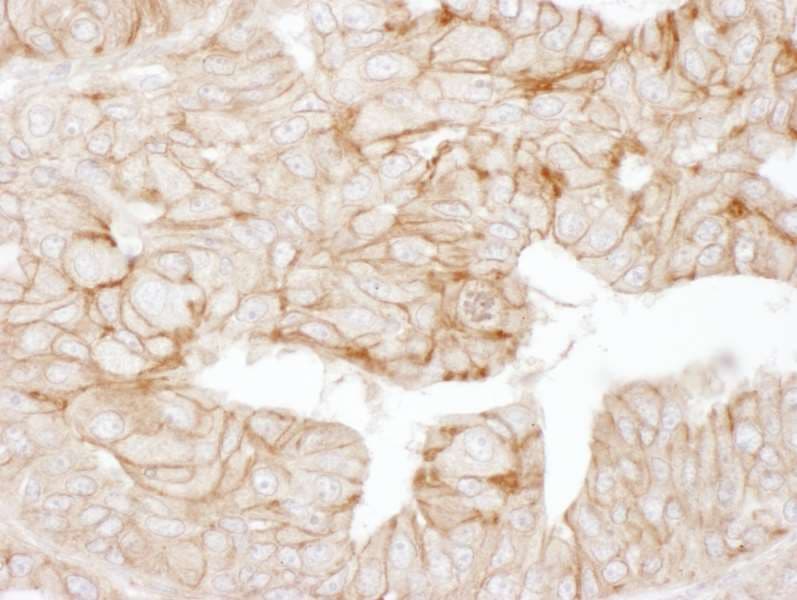 ADD1 / Adducin Alpha Antibody (aa550-600)