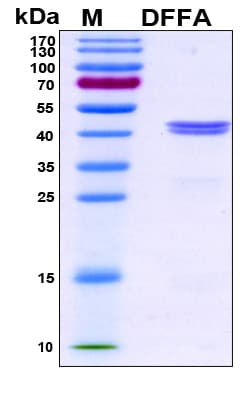 Human DFFA / ICAD / DFF45 Protein (Recombinant His, N-Terminal)