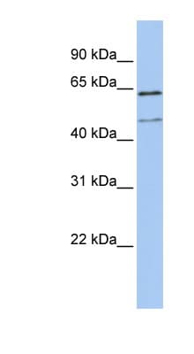 Polyclonal Rabbit anti-Human LAMP3 / CD208 Antibody (aa36-85, WB)