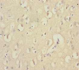 Polyclonal Rabbit anti-Human EEF1A2 Antibody (IHC, WB)
