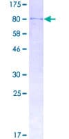 Human CT26 / DDX53 Protein (Recombinant GST)
