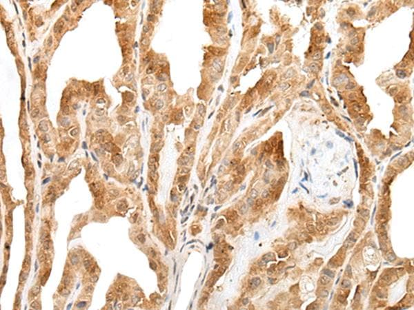 ZPBP / SP38 Antibody