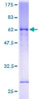 Human GRIK2 / GLUR6 Protein (Recombinant GST)