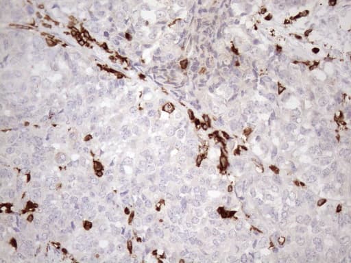 URP2 / FERMT3 Antibody (aa259-528, clone OTI2G2)