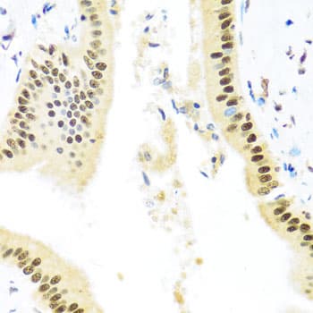 ZBTB17 / MIZ-1 Antibody