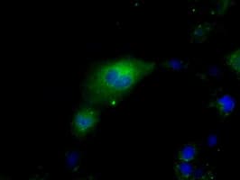 Heat Shock Protein 70 / HSPA1A Antibody (clone OTI2C12)