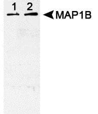 MAP1B Antibody (phospho-Thr1265, DY488)