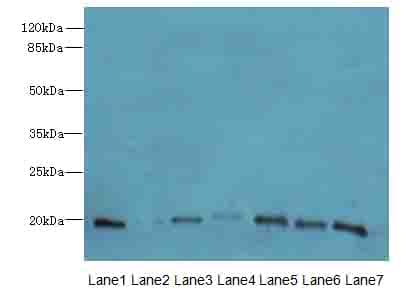 IHC-plus™ Polyclonal Rabbit anti-Human PARK7 / DJ-1 Antibody (IHC, IF, WB)