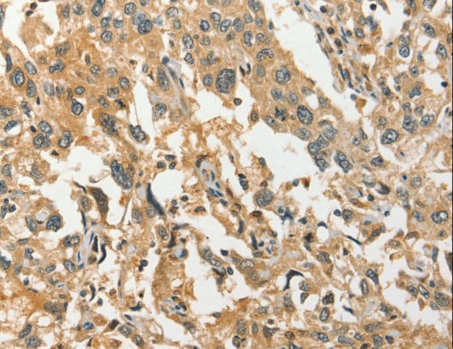 GBTS1 / DIRAS1 Antibody