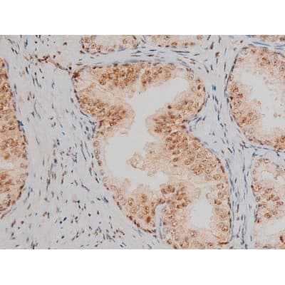 AP-1 / JUND Antibody (phospho-Ser255)