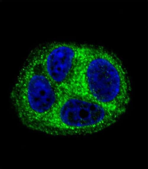 QTRTD1 Antibody (aa321-350)
