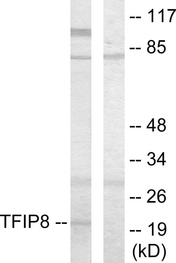 TNFAIP8 / SCC-S2 Antibody