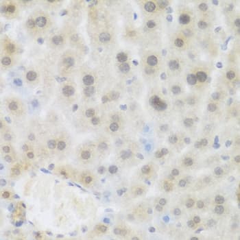 Polyclonal Rabbit anti-Human BRD9 Antibody (IHC, WB)