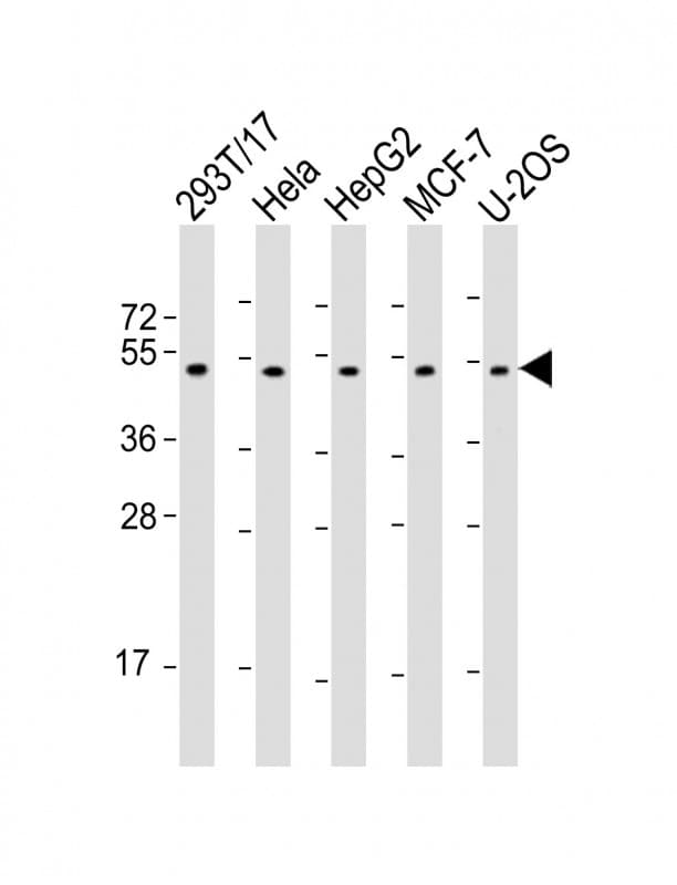 PLAGL1 / ZAC Antibody (aa112-146)