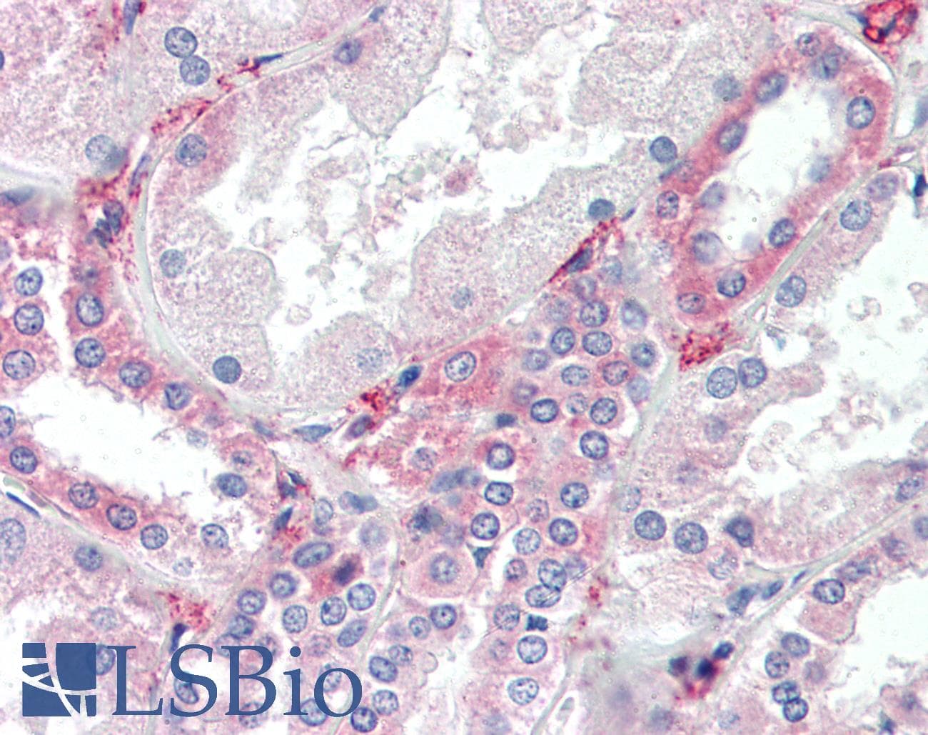 IHC-plus™ Polyclonal Rabbit anti-Human SYVN1 / HRD1 Antibody (aa586-617, IHC, IF, WB)