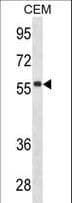 Monoclonal Mouse anti-Human IgD Heavy Chain Antibody (aa37-64, WB)