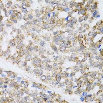 ZAK / MLTK Antibody