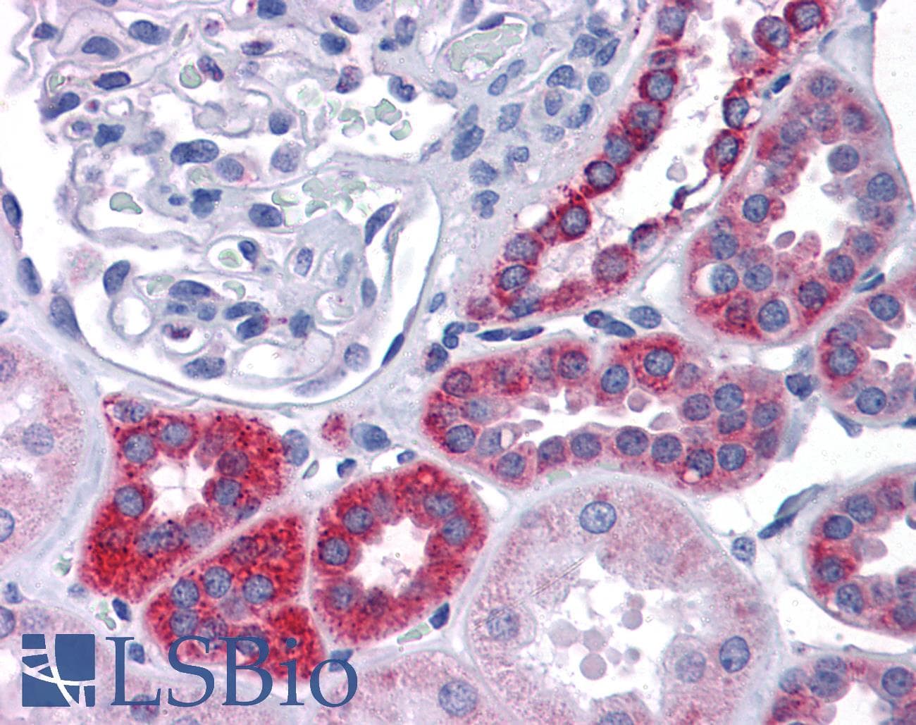 IHC-plus™ Monoclonal Mouse anti-Human IDH2 Antibody (clone 5F11, IHC, WB)