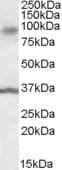 IHC-plus™ ANKK1 Antibody (aa482-496)