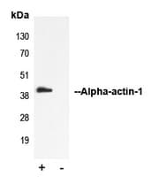 ACTA1 / Skeletal Muscle Actin Antibody (N-Terminus)