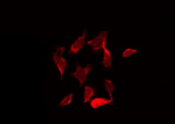 CAMK2A / CaMKII Alpha Antibody