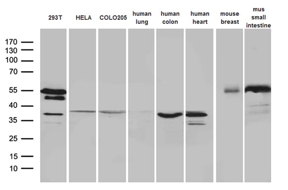 Monoclonal Mouse anti-Human SFRP2 Antibody (clone OTI6C2, Carrier-free, aa25-295, IHC, WB)