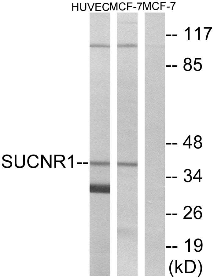 Polyclonal Rabbit anti-Human SUCNR1 / GPR91 Antibody (WB)