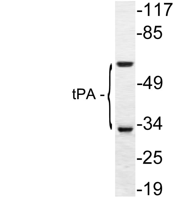 PLAT / TPA Antibody (aa38-87)