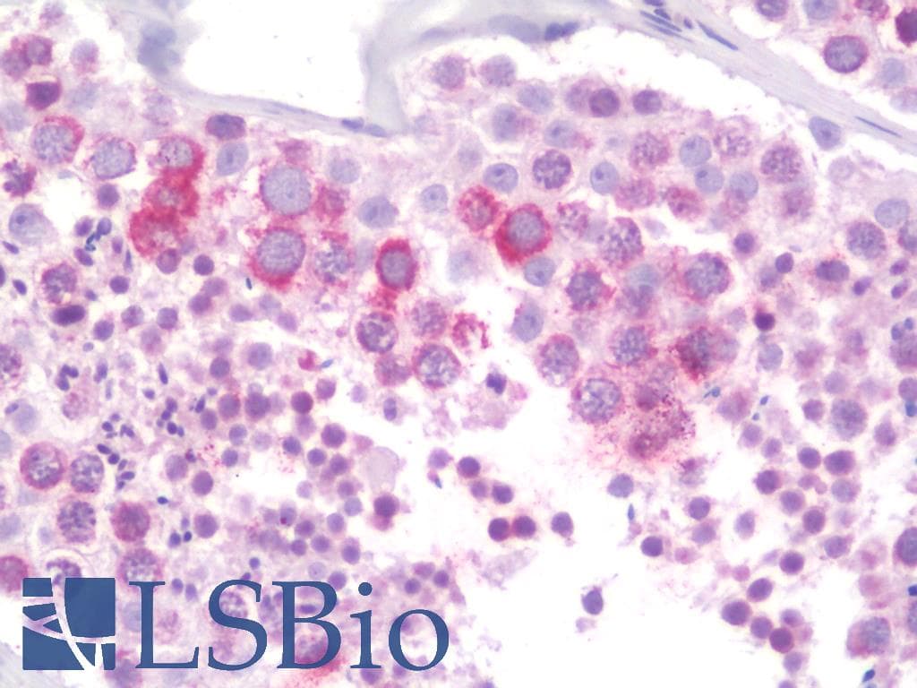 PathPlus™ RTN4RL2 Antibody