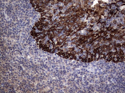Monoclonal Mouse anti-Human CCL19 / MIP3-Beta Antibody (clone OTI2A12, aa22-98, IHC)