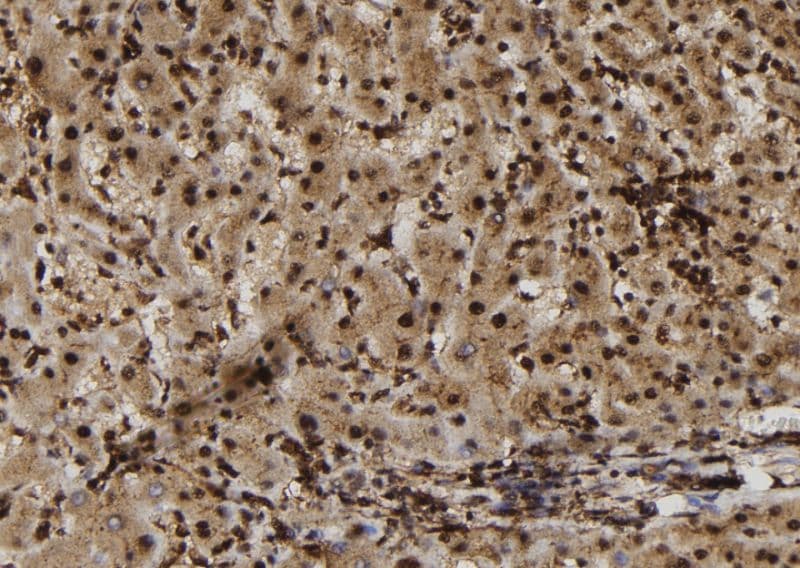 SULT1E1 / Sulfotransferase 1E1 Antibody