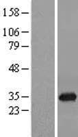 ORC6 / ORC6L Protein (Over-Expression Lysate Myc-DDK (Flag))