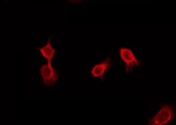 Polyclonal Rabbit anti-Human ADGRD2 / GPR144 Antibody (IF, WB)