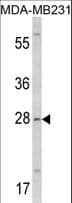 Polyclonal Rabbit anti-Human COLEC11 Antibody (aa50-78, IHC, WB)