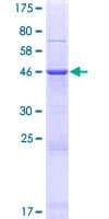 Human AKAP14 Protein (Recombinant GST)