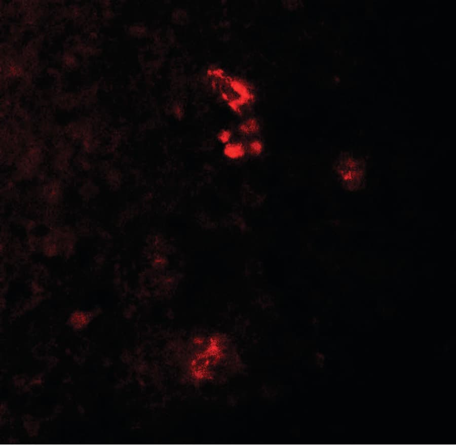 IHC-plus™ PRKCDBP / CAVIN3 Antibody
