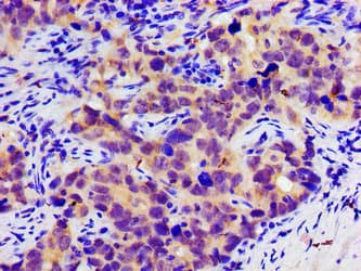SLC25A12 / ARALAR Antibody