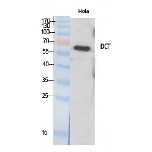 DCT / Dopachrome Tautomerase Antibody (30-110 aa, Internal)
