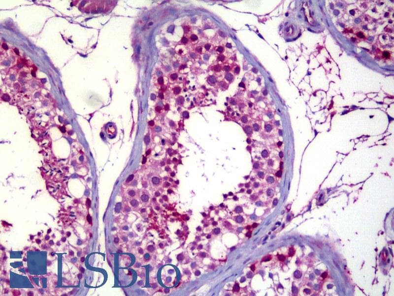IHC-plus™ LGALS8 / Galectin 8 Antibody (aa61-110)