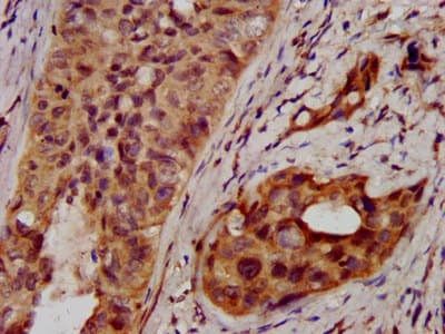 Polyclonal Rabbit anti-Human NSDHL Antibody (IHC, IF, WB)