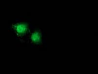 CTNNB1 / Beta Catenin Antibody (clone OTI9F6)