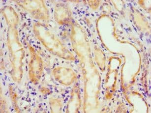 Polyclonal Rabbit anti-Human ABH2 / ALKBH2 Antibody (aa1-261, IHC)