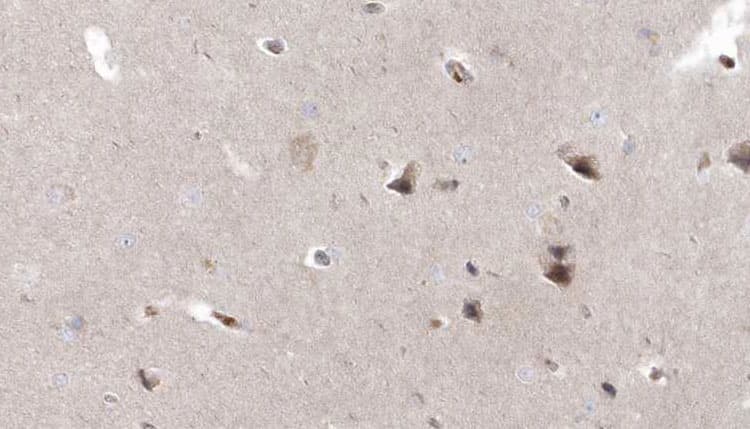 RPGRIP1L Antibody