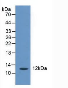 CRADD / RAIDD Antibody (aa1-199)
