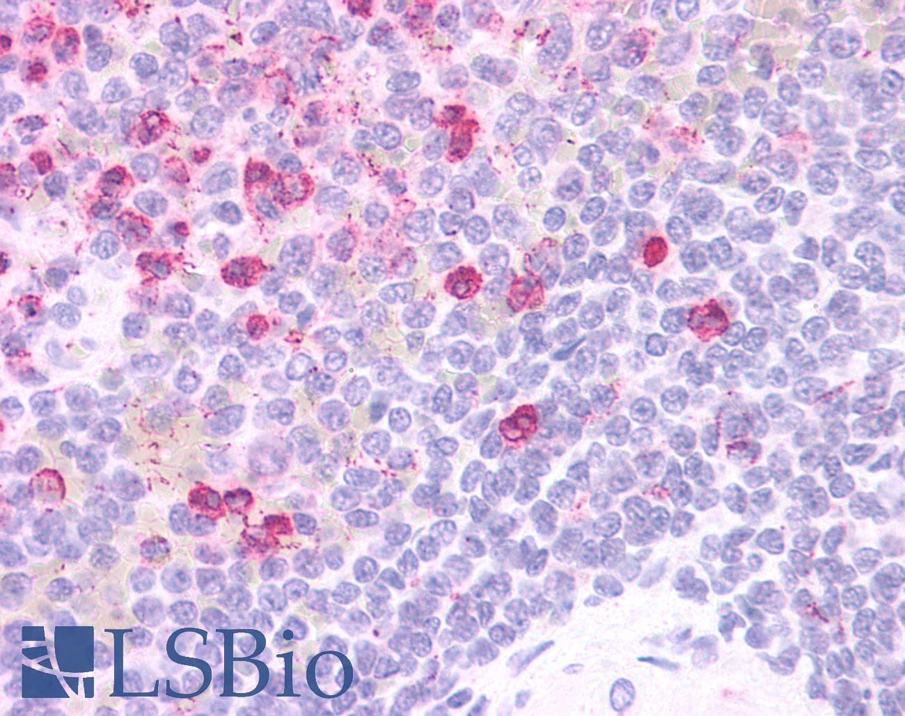 IHC-plus™ HCAR3 / GPR109B / HM74 Antibody (Cytoplasmic Domain)