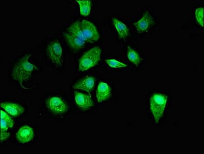 Polyclonal Rabbit anti-Human GUCD1 Antibody (IHC, IF, WB)