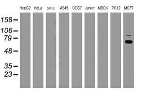 RPS6KB1 / P70S6K / S6K Antibody (clone OTI1G4, Carrier-free)
