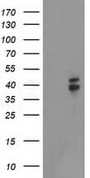 NUDEL / NDEL1 Antibody (clone OTI5E11)
