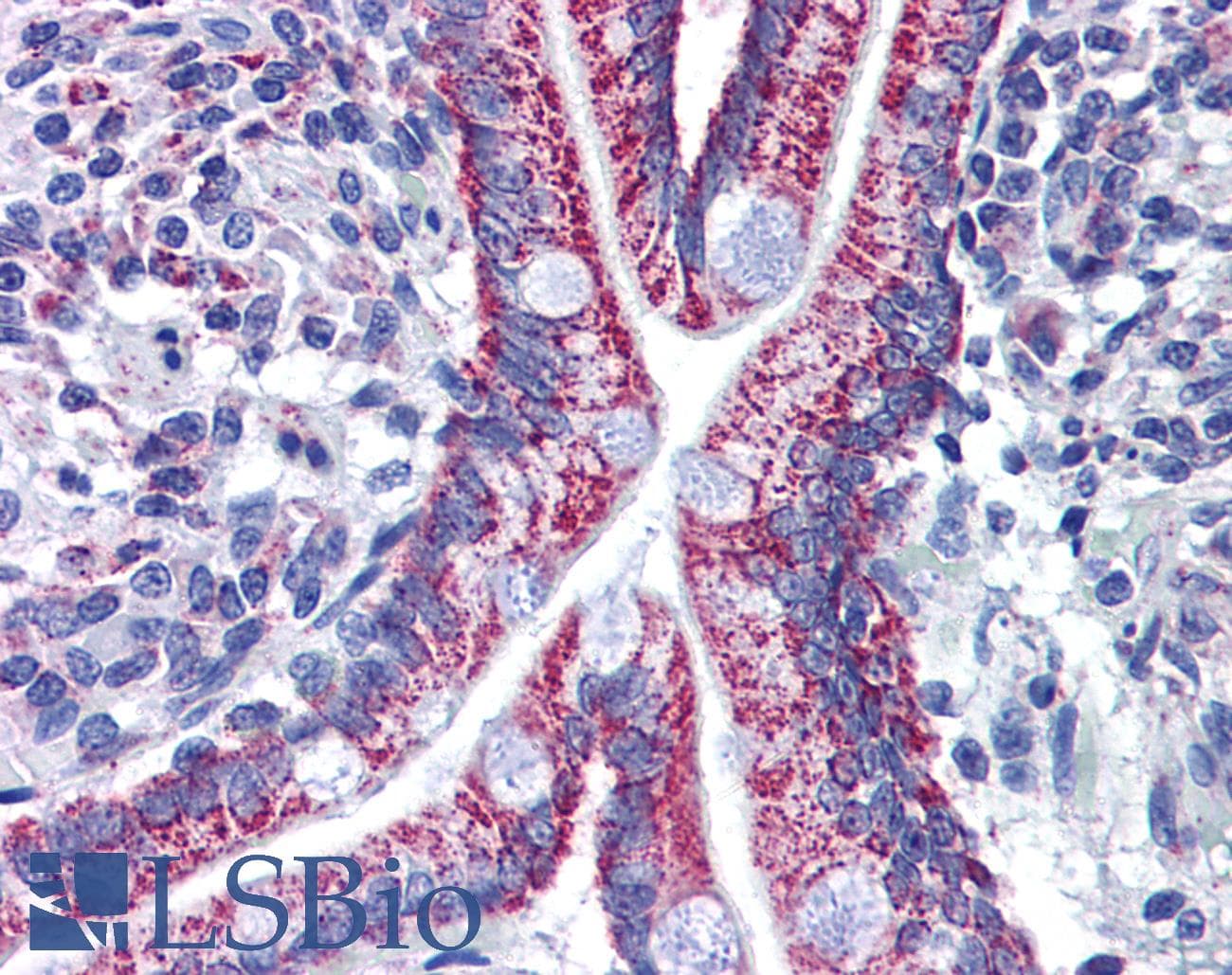 IHC-plus™ ACAA2 Antibody (clone 5C4)