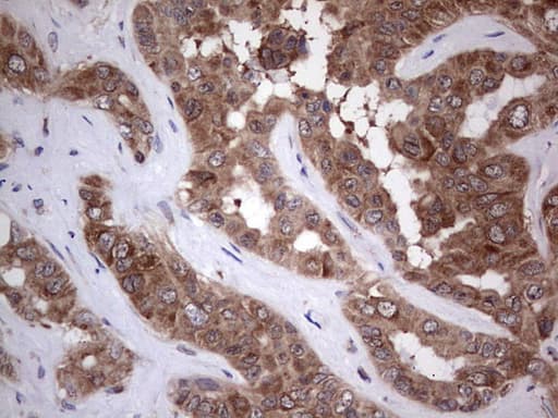 PIK3CA / PI3K Alpha Antibody (aa303-631, clone OTI7A7)